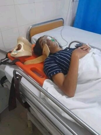 എസ്എഫ്ഐ നേതാവ് അപർണ്ണ ഗൗരിക്ക് അക്രമത്തിൽ ഗുരുതര പരുക്ക്