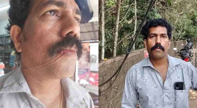 കൊച്ചിയില്‍ കേബിള്‍ കഴുത്തില്‍ കുരുങ്ങി വീണ്ടും അപകടം